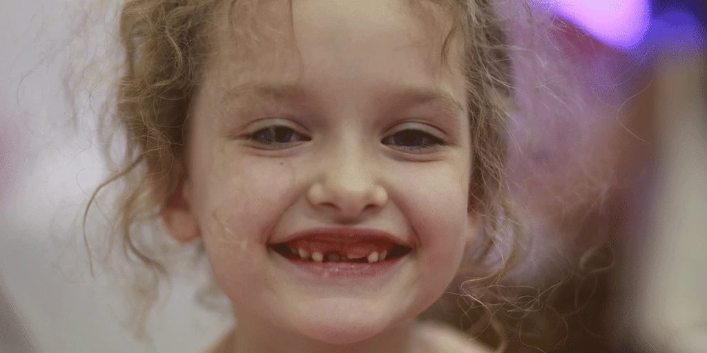 Thumb Sucking Effects on Teeth: When Should Parents Be Concerned?
