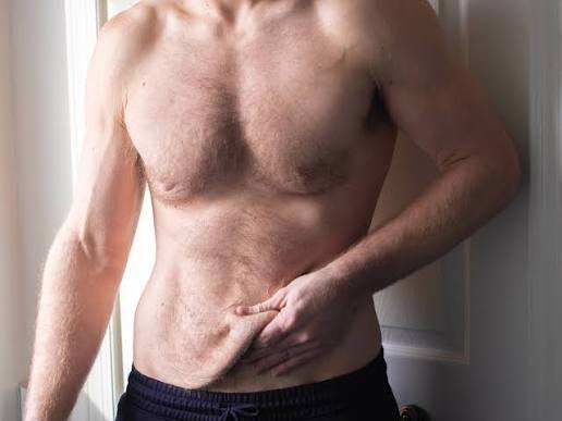 The Real Math Behind Firming Loose Skin After Major Weight Loss